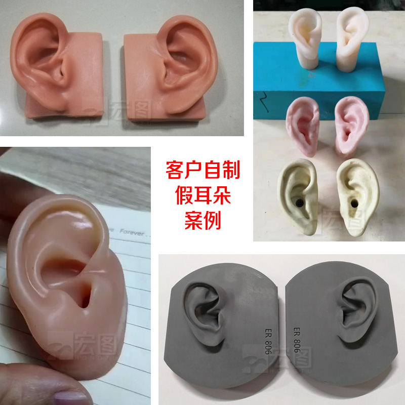 假耳朵硅胶宏图案例 假耳朵硅胶宏图案例