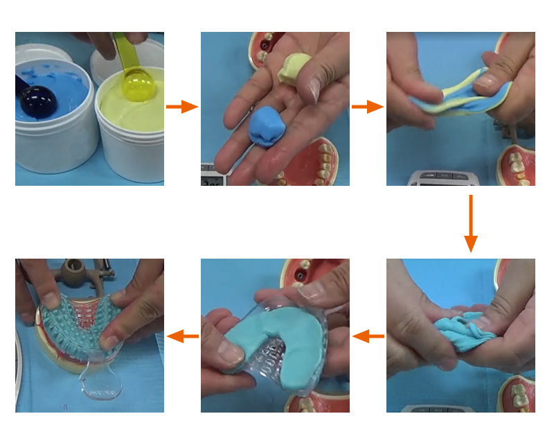 牙模模具硅橡胶操作 牙模模具硅橡胶操作